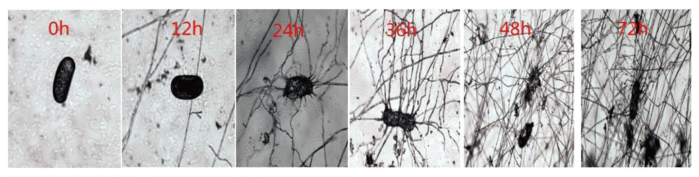 Biocontrol Agent Of Root-Knot Nematode_03